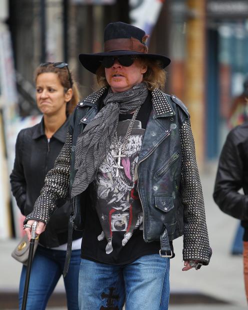 Axl Rose a New York a spasso con il bastone