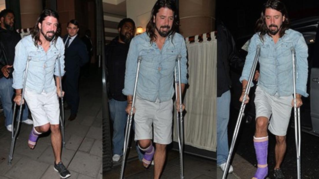 Dave Grohl potrebbe avere problemi a camminare per mesi!