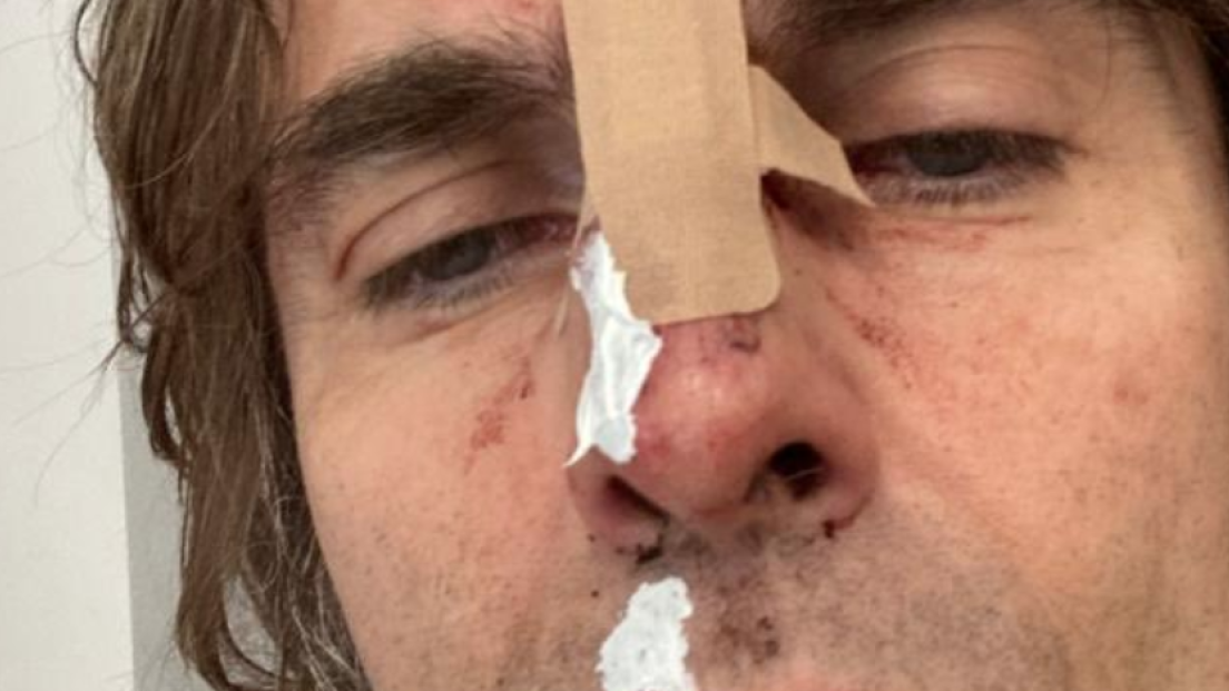Liam Gallagher