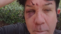 Crazy Town, violenta rissa tra i due cantanti Shifty Shellshock e Bobby Reeves. Guarda il video