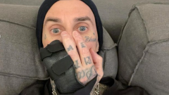 Travis Barker è stato operato alla mano in vista del tour con i Blink-182